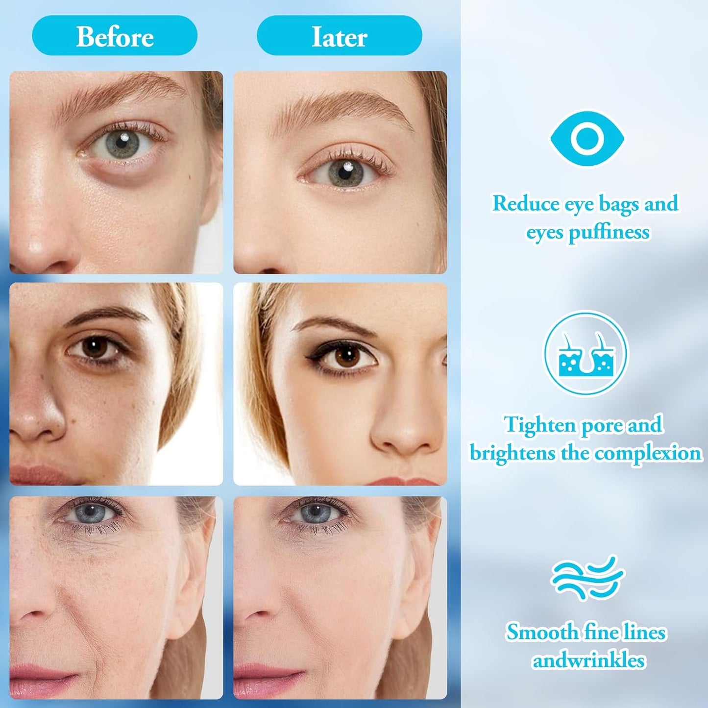 Woman using cooling glass globes on her face for skin tightening.
