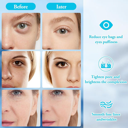 Woman using cooling glass globes on her face for skin tightening.
